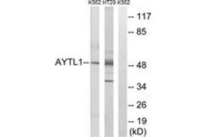 Western Blotting (WB) image for anti-Lysophosphatidylcholine Acyltransferase 2 (LPCAT2) (AA 321-370) antibody (ABIN2890096) (LPCAT2 抗体  (AA 321-370))