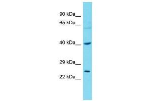 Host:  Rabbit  Target Name:  Tfdp2  Sample Type:  Rat Stomach lysates  Antibody Dilution:  1. (DP2 抗体  (N-Term))