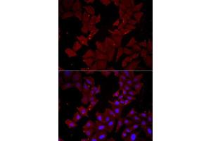 Immunofluorescence (IF) image for anti-Chaperonin Containing TCP1, Subunit 4 (Delta) (CCT4) (AA 130-390) antibody (ABIN6138108)