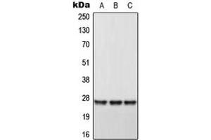Western blot analysis of DHRS2 expression in HeLa (A), Raw264. (DHRS2 抗体  (Center))