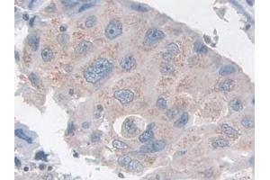 Immunohistochemistry (IHC) image for anti-Tachykinin Receptor 2 (TACR2) (AA 92-290) antibody (ABIN7432214)