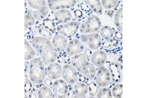 Immunohistochemistry of paraffin-embedded mouse kidney using SSN Rabbit pAb (3377) at dilution of 1:100 (40x lens). (SSNA1 抗体  (AA 1-119))
