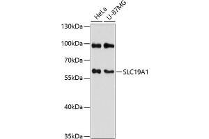 Western blot analysis of extracts of various cell lines, using SLC19 antibody (2819) at 1:3000 dilution. (SLC19A1 抗体  (AA 452-591))