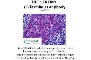 Image no. 1 for anti-FRAS1 Related Extracellular Matrix 1 (FREM1) (C-Term) antibody (ABIN1734463) (FREM1 抗体  (C-Term))