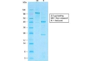 SDS-PAGE Analysis of Purified CD1a-Monospecific RecombinantRabbit Monoclonal Antibody (C1A/1506R). (Recombinant CD1a 抗体)