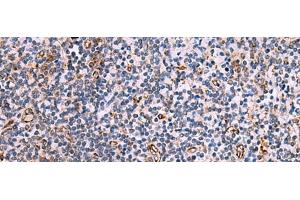 Immunohistochemistry of paraffin-embedded Human tonsil tissue using ITGA11 Polyclonal Antibody at dilution of 1:75(x200) (ITGA11 抗体)