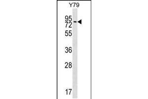 Western blot analysis in Y79 cell line lysates (35ug/lane). (MAK 抗体  (C-Term))