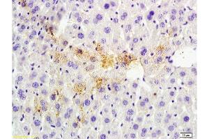 Immunohistochemistry (Paraffin-embedded Sections) (IHC (p)) image for anti-Tumor Susceptibility Gene 101 (TSG101) (AA 4-120) antibody (ABIN685507)