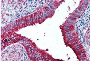 Human Uterus (formalin-fixed, paraffin-embedded) stained with FUT4 antibody ABIN297072 at 1:50 followed by biotinylated anti-mouse IgG secondary antibody ABIN481714, alkaline phosphatase-streptavidin and chromogen. (CD15 抗体)