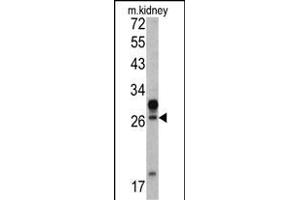 Western blot analysis of HOXA5 antibody (C-term ) (ABIN390648 and ABIN2840947) in mouse kidney tissue lysates (35 μg/lane). (HOXA5 抗体  (C-Term))