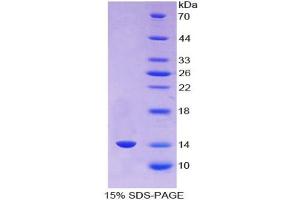 SDS-PAGE analysis of Human AGGF1 Protein. (AGGF1 蛋白)