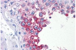 Human Testis: Formalin-Fixed, Paraffin-Embedded (FFPE) (ART3 抗体  (AA 29-139))