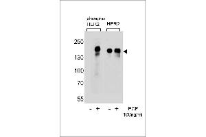 Western blot analysis of extracts from A431 cells,untreated or treated with EGF,100 ng/mL,using phospho HER2- (left) or HER2 Antibody (right) (ErbB2/Her2 抗体  (pTyr1112))