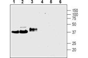 Western blot analysis of rat brain membranes (lanes 1 and 4), mouse brain membranes (lanes 2 and 5) and rat PC12 pheochromocytoma cell line lysate (lanes 3 and 6):1-3.