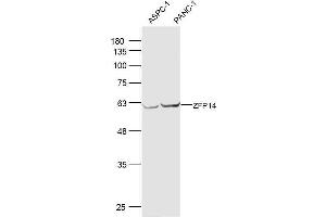 Lane 1: ASPC-1 lysates Lane 2: PANC-1 lysates probed with ZFP14 Polyclonal Antibody, Unconjugated  at 1:300 dilution and 4˚C overnight incubation. (ZFP14 抗体  (AA 121-220))