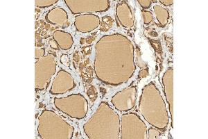 IHC analysis of Citrin/SLC25A13 using anti-Citrin/SLC25A13 antibody (ABIN7599512). (slc25a13 抗体  (AA 1-643))