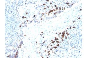 Formalin-fixed, paraffin-embedded human tonsil stained with IgA Recombinant Mouse Monoclonal Antibody (rHISA43). (Recombinant IGHA1 & IGHA2 抗体)