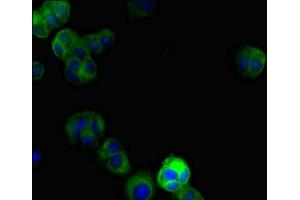 Immunofluorescent analysis of MCF-7 cells using ABIN7150145 at dilution of 1:100 and Alexa Fluor 488-congugated AffiniPure Goat Anti-Rabbit IgG(H+L) (DRAM2 抗体  (AA 182-266))