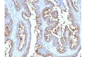 Immunohistochemistry (IHC) image for anti-5'-Nucleotidase, Ecto (CD73) (NT5E) antibody (ABIN6940229)