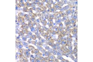 Immunohistochemistry of paraffin-embedded mouse liver using CCBL1 antibody (ABIN5973926) at dilution of 1/100 (40x lens). (CCBL1 抗体)