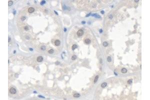 Detection of SMN2 in Human Kidney Tissue using Polyclonal Antibody to Survival Of Motor Neuron 2, Centromeric (SMN2) (SMN2 抗体  (AA 16-251))