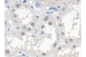 Detection of SMN2 in Human Kidney Tissue using Polyclonal Antibody to Survival Of Motor Neuron 2, Centromeric (SMN2)