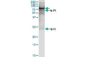 Immunoprecipitation of ASMTL transfected lysate using anti-ASMTL MaxPab rabbit polyclonal antibody and Protein A Magnetic Bead , and immunoblotted with ASMTL MaxPab rabbit polyclonal antibody (D01) . (ASMTL 抗体  (AA 1-621))