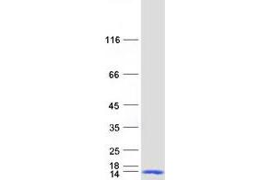 Validation with Western Blot