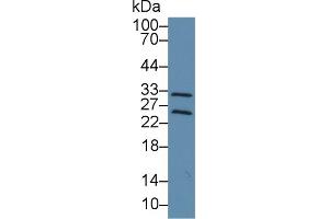 Western Blot; Sample: Rat Cerebrum lysate; ;Primary Ab: 3µg/ml Rabbit Anti-Mouse TIMP4 Antibody;Second Ab: 0. (TIMP4 抗体  (AA 42-224))