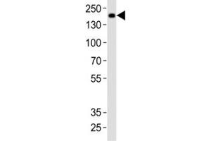 Western blot analysis of lysate from rat brain tissue using Insrr antibody at 1:1000. (INSRR 抗体  (C-Term))