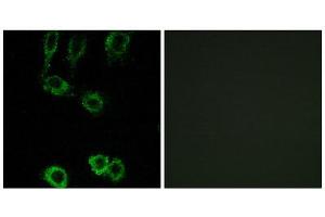 Immunofluorescence (IF) image for anti-Calponin 2 (CNN2) (Internal Region) antibody (ABIN1850970) (CNN2 抗体  (Internal Region))