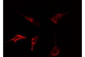 ABIN6278565 staining Hela cells by IF/ICC. (DOK5 抗体  (C-Term))