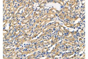 ABIN6263797 and ABIN6278500 at 1/100 staining Mouse kidney tissue by IHC-P.