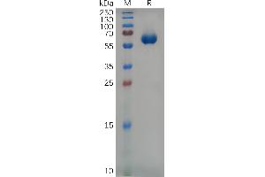 SDS-PAGE (SDS) image for Catalase (CAT) (AA 23-224) protein (Fc Tag) (ABIN7092847)