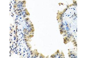 Immunohistochemistry of paraffin-embedded Mouse lung using ARSF Polyclonal Antibody at dilution of 1:100 (40x lens). (ARSF 抗体)