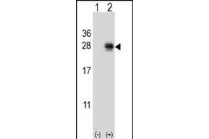 Western Blotting (WB) image for anti-Pro-Melanin-Concentrating Hormone (PMCH) (AA 94-122) antibody (ABIN651719)