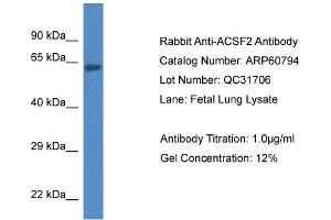 Western Blotting (WB) image for anti-Acyl-CoA Synthetase Family Member 2 (ACSF2) (C-Term) antibody (ABIN2788584) (ACSF2 抗体  (C-Term))