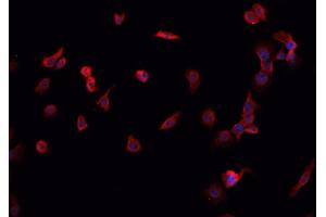 ABIN6266863 staining K-562 cells by IF/ICC. (MORF4L1 抗体  (N-Term))