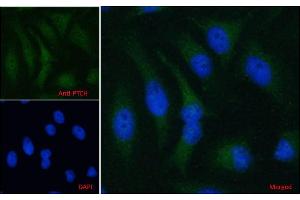 ABIN185521 Immunofluorescence analysis of paraformaldehyde fixed HeLa cells, permeabilized with 0. (Patched 1 抗体  (C-Term))