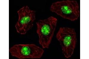 Fluorescent image of A549 cell stained with NPM1 antibody. (NPM1 抗体  (AA 7-33))
