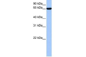 WB Suggested Anti-hCG_1646157 Antibody Titration:  0. (Zinc Finger Protein 891 (ZNF891) (N-Term) 抗体)