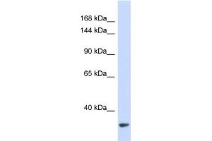 Western Blotting (WB) image for anti-MDM2 Binding Protein (MTBP) (Middle Region) antibody (ABIN2446252) (MTBP 抗体  (Middle Region))