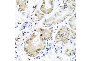 Immunohistochemistry of paraffin-embedded human stomach using PCBP1 antibody. (PCBP1 抗体)