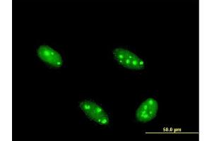 Immunofluorescence of monoclonal antibody to NFIA on HeLa cell.