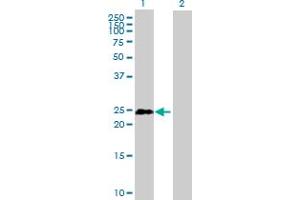 Western Blot analysis of TCEAL1 expression in transfected 293T cell line by TCEAL1 MaxPab polyclonal antibody. (TCEAL1 抗体  (AA 1-159))