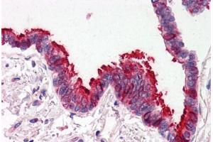 Human Lung, Respiratory Epithelium (formalin-fixed, paraffin-embedded) stained with SKIL antibody ABIN214478 at 2. (SKIL 抗体  (N-Term))