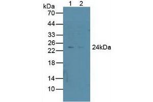 Figure. (PSMD10 抗体  (AA 1-226))