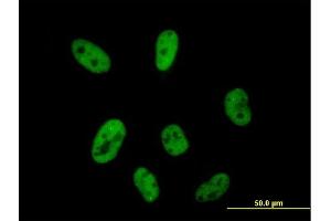 Immunofluorescence of purified MaxPab antibody to CPSF2 on HeLa cell. (CPSF2 抗体  (AA 1-782))