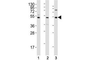 Western blot testing of LAG3 antibody at 1:2000 dilution tested on human lysates, Lane 1: K562; 2: liver; 3: ovary; Predicted molecular weight ~54 kDa. (LAG3 抗体  (AA 103-132))