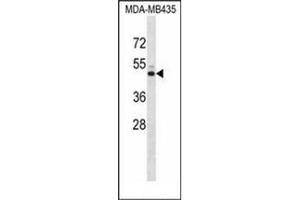 Western blot analysis of KCNJ13 Antibody (N-term) in MDA-MB435 cell line lysates (35ug/lane).